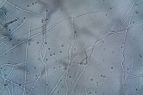 Mantarlarin-Zihni-Var-Mi-Bilimin-Fungal-Zekaya-Bakisi-featured